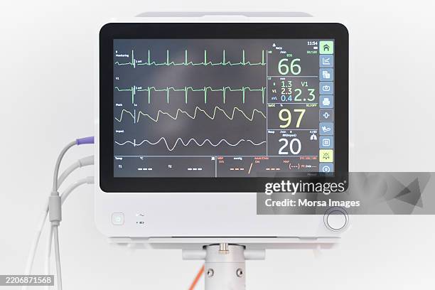 Digital Vital Signs Monitor